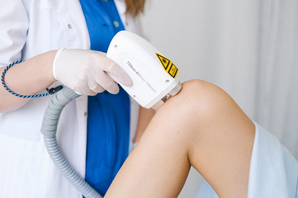 depilacja laser